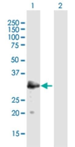 Anti-MAST4 antibody produced in mouse