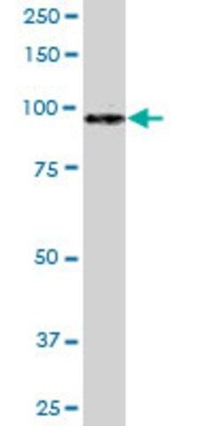 Anti-MATN2 antibody produced in rabbit