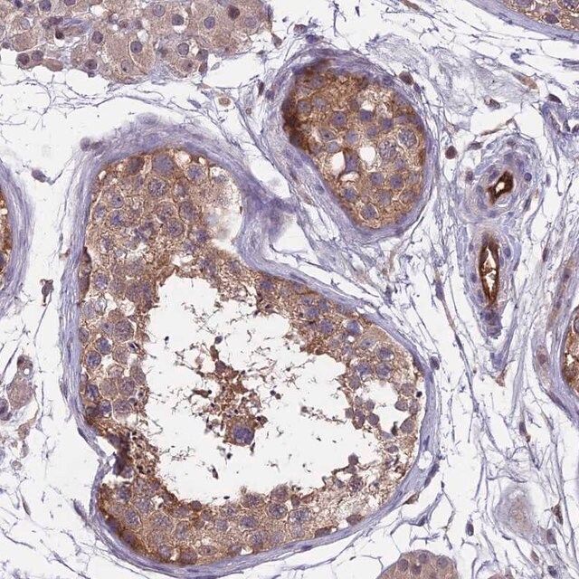 Anti-MAST2 antibody produced in rabbit