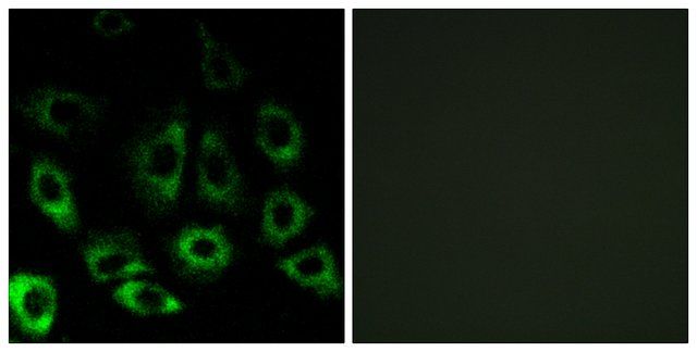 Anti-MBTPS2 antibody produced in rabbit