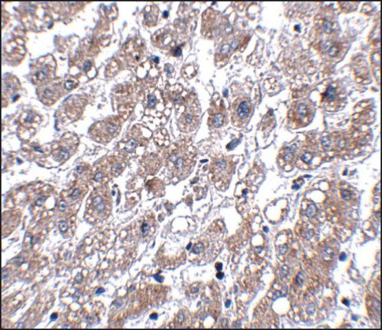 Anti-MATN1 antibody produced in rabbit