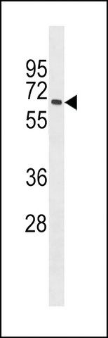 ANTI-MBOAT7 (CENTER) antibody produced in rabbit