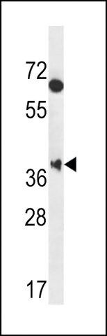 ANTI-MBNL2(C-TERMINAL) antibody produced in rabbit