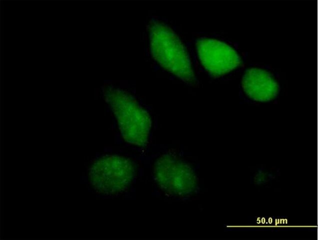 Anti-MBD1 antibody produced in mouse