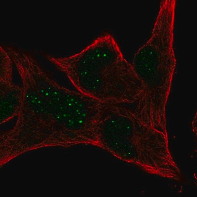 Anti-MBLAC2 antibody produced in rabbit