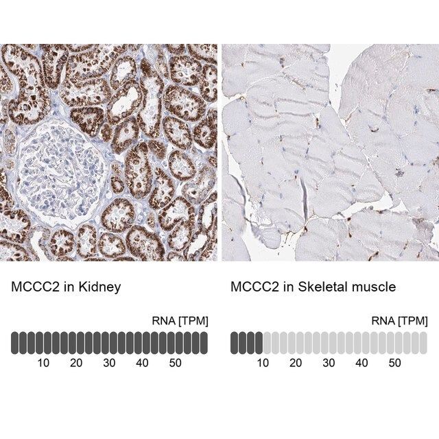 Anti-MCCC2 antibody produced in rabbit