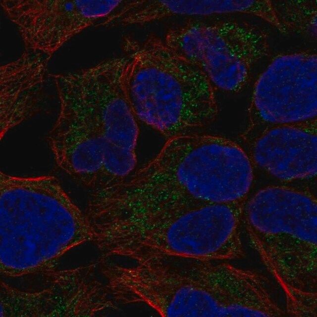 Anti-MCAT antibody produced in rabbit