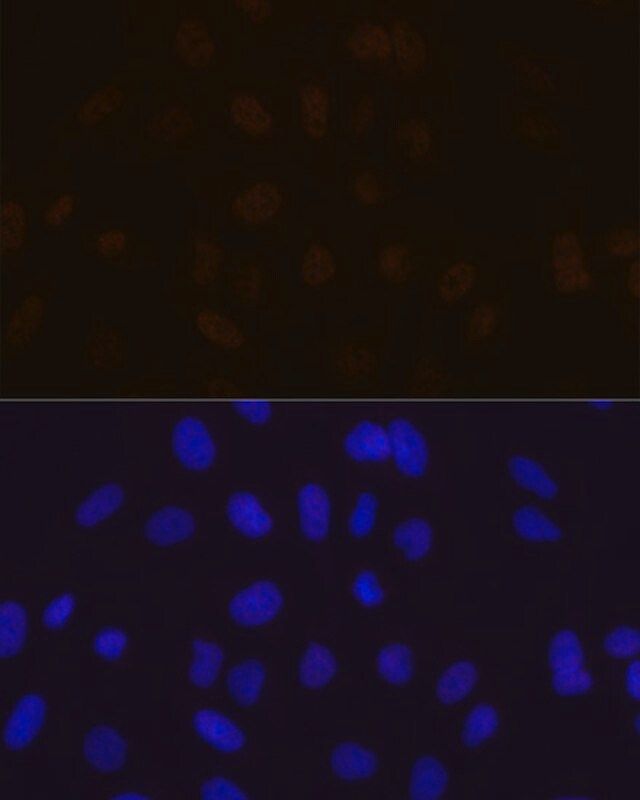 Anti-MBNL1 antibody produced in rabbit