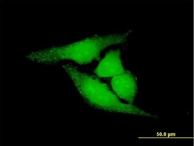 Anti-LOC81691 antibody produced in mouse