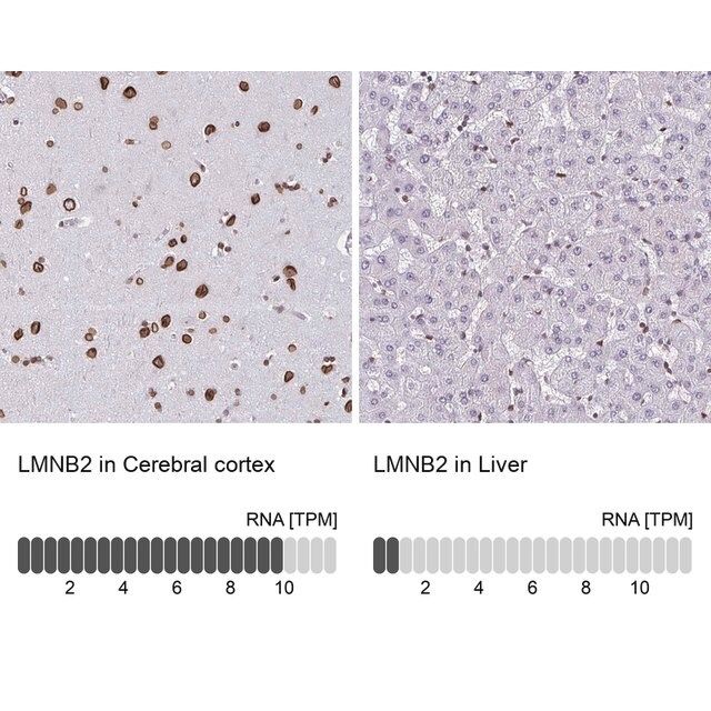 Anti-LMNB2 antibody produced in rabbit