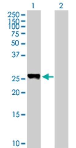 Anti-LOC440456 antibody produced in mouse