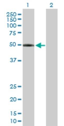 Anti-LPCAT2 antibody produced in mouse