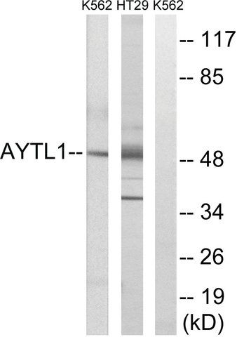 Anti-LPCAT2 antibody produced in rabbit