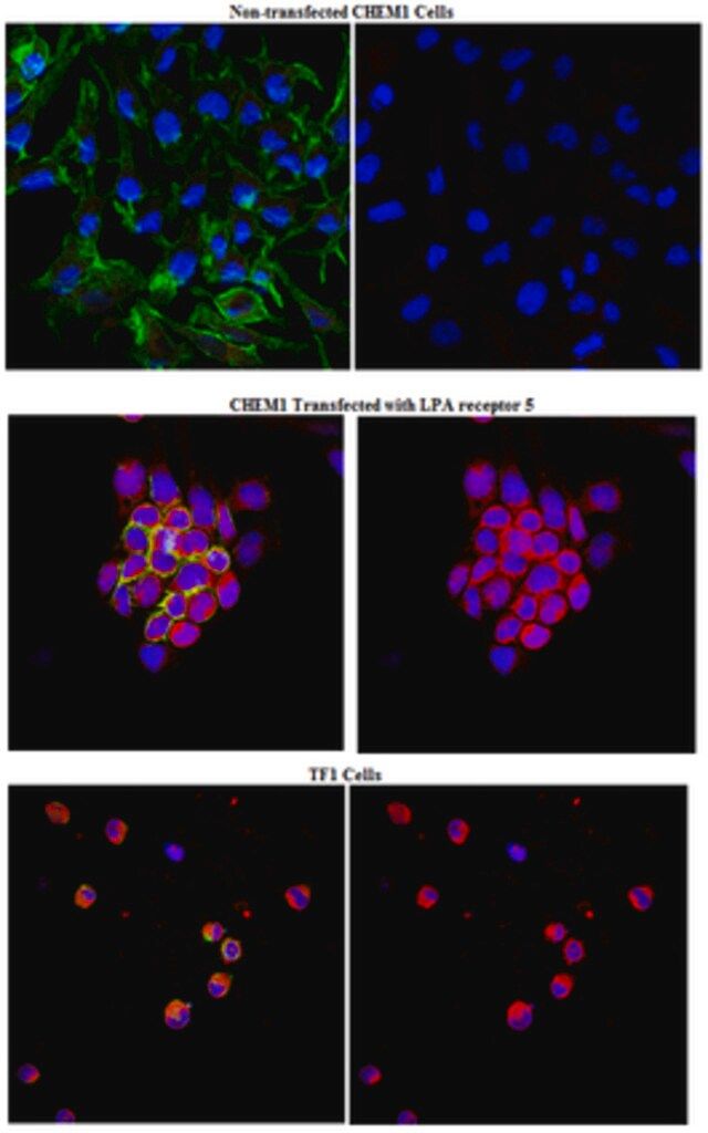 Anti-LPA receptor 5 Antibody (GPR92)