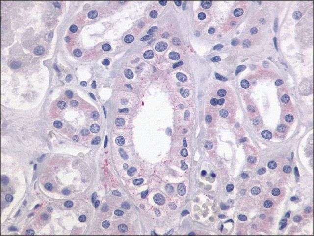 Anti-LPAR4 / GPR23 antibody produced in rabbit