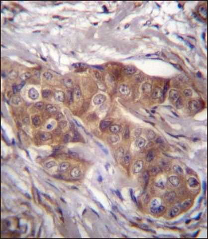 ANTI-LPAR6 (CENTER) antibody produced in rabbit