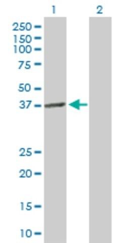 Anti-LPGAT1 antibody produced in mouse