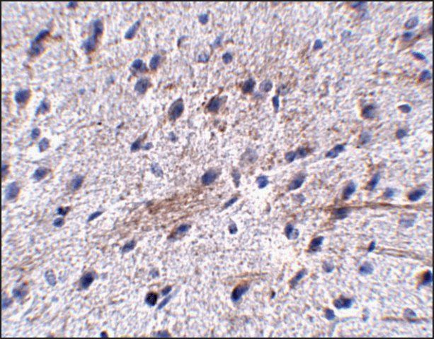 Anti-LRFN5 antibody produced in rabbit