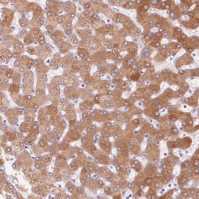 Anti-LPA antibody produced in rabbit