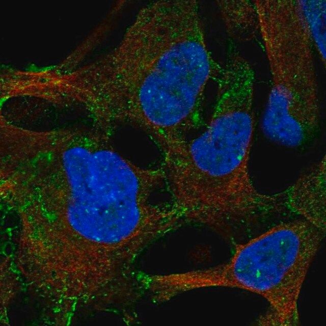 Anti-LPAR4 antibody produced in rabbit