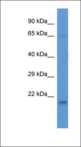 Anti-LSMD1 antibody produced in rabbit