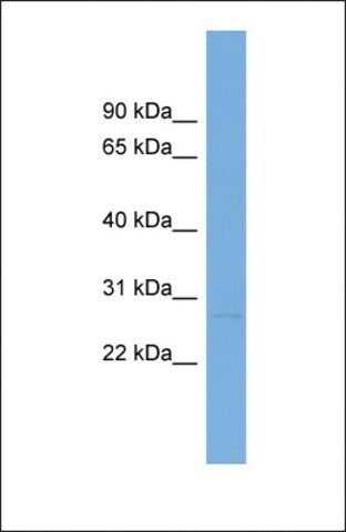 Anti-LTB antibody produced in rabbit