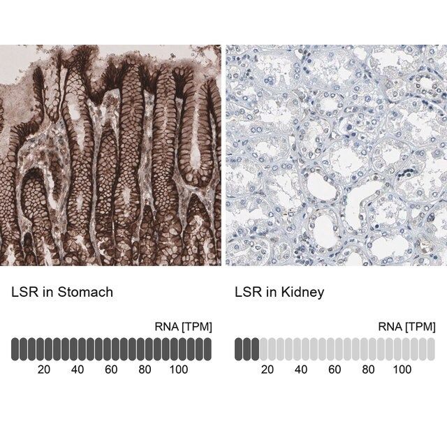 Anti-LSR antibody produced in rabbit