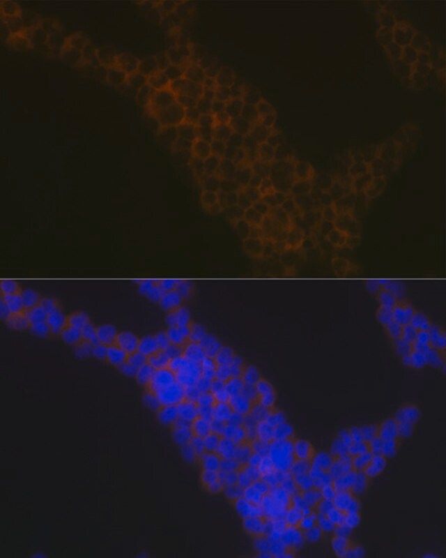 Anti-LSP1 antibody produced in rabbit