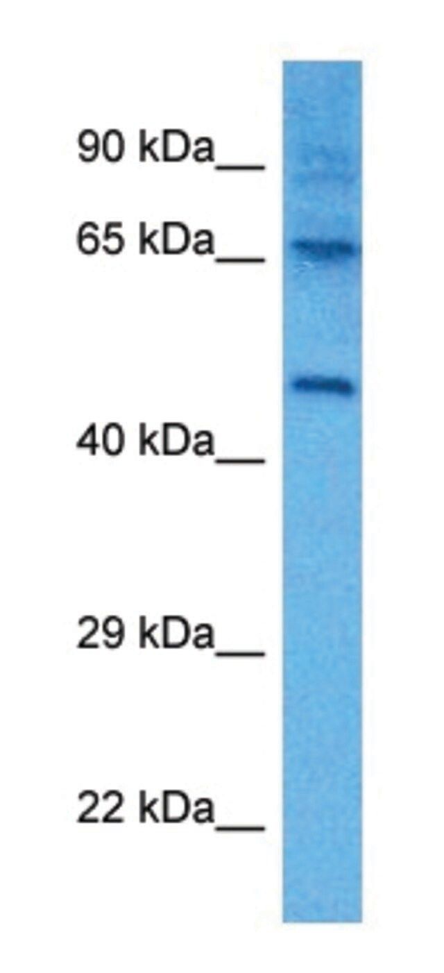 Anti-LTBR (C-terminal) antibody produced in rabbit