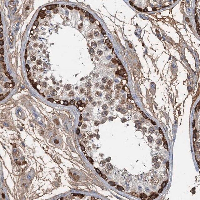 Anti-LSM14B antibody produced in rabbit