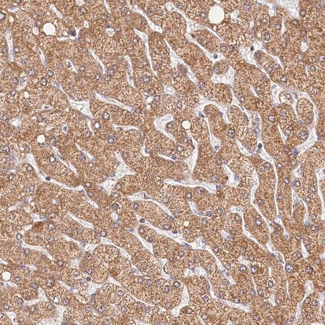 Anti-LSS antibody produced in rabbit