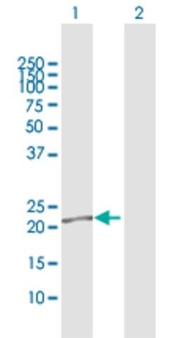 Anti-LCN2 antibody produced in rabbit