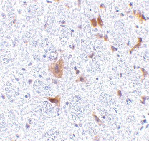 Anti-LFG antibody produced in rabbit