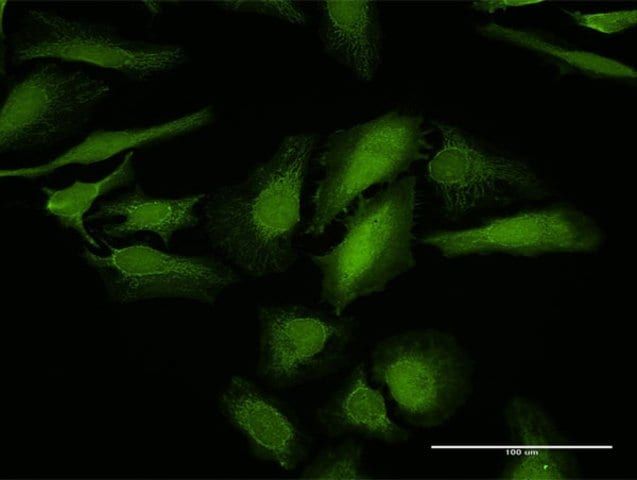 Anti-LGALS1 antibody produced in rabbit