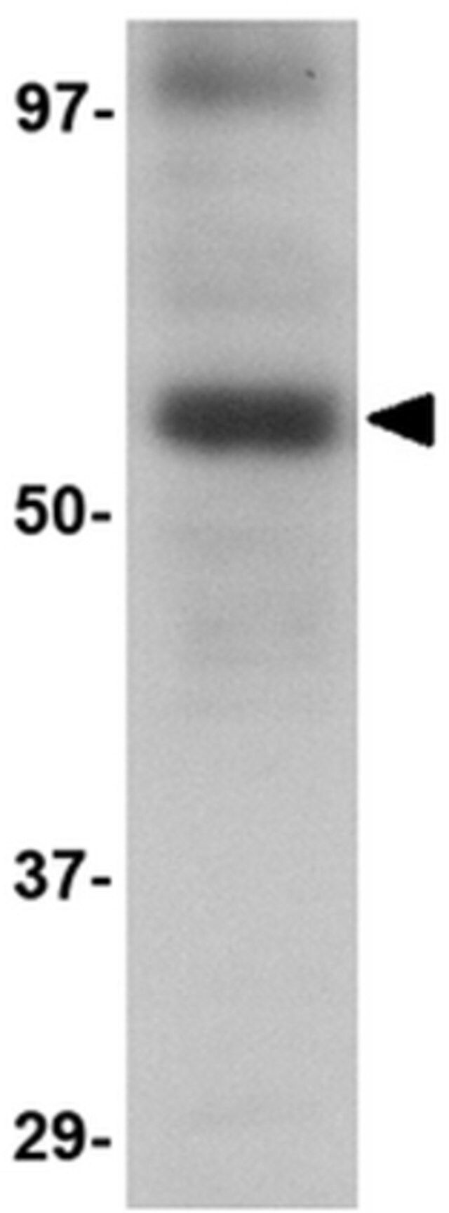 Anti-LGI3 Antibody