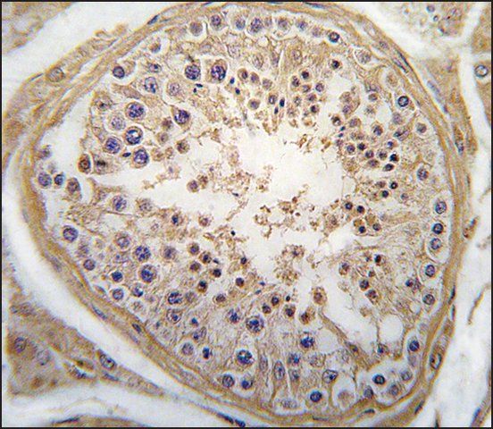 Anti-LHB (C-term) antibody produced in rabbit