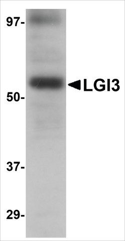 Anti-LGI3 antibody produced in rabbit