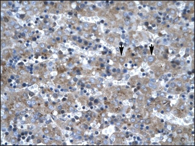 Anti-LHX6 antibody produced in rabbit