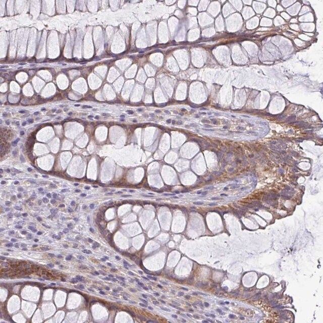 Anti-LMF2 antibody produced in rabbit