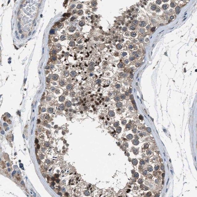 Anti-LMLN antibody produced in rabbit