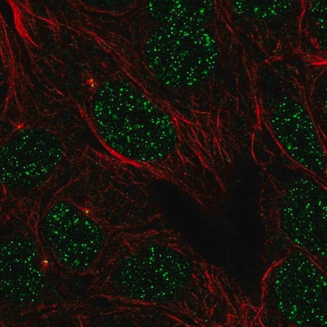 Anti-LMNTD1 antibody produced in rabbit