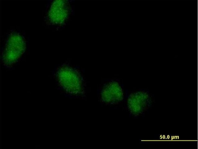 Anti-LMCD1 antibody produced in mouse