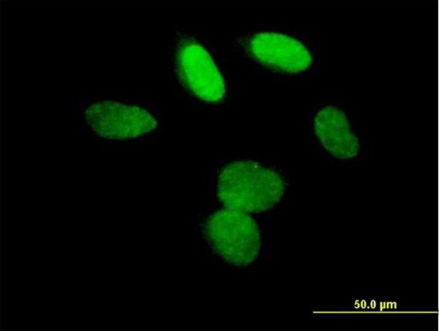 Anti-L3MBTL3 antibody produced in mouse