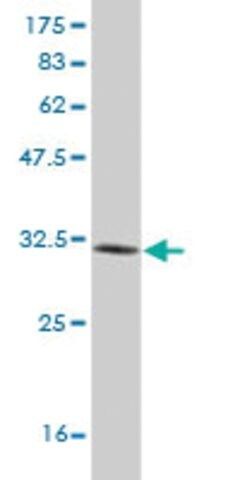 ANTI-LMO3 antibody produced in mouse