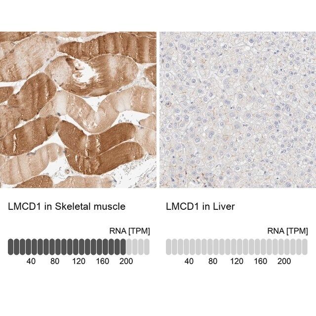 Anti-LMCD1 antibody produced in rabbit