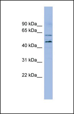 Anti-LMF1, (N-terminal) antibody produced in rabbit