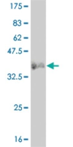 ANTI-LMO2 antibody produced in mouse