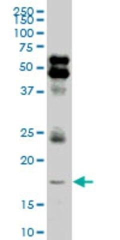 ANTI-LMO2 antibody produced in mouse