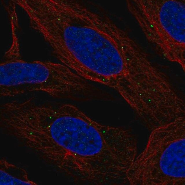 Anti-LMNTD2 antibody produced in rabbit