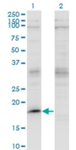 ANTI-LMO2 antibody produced in mouse